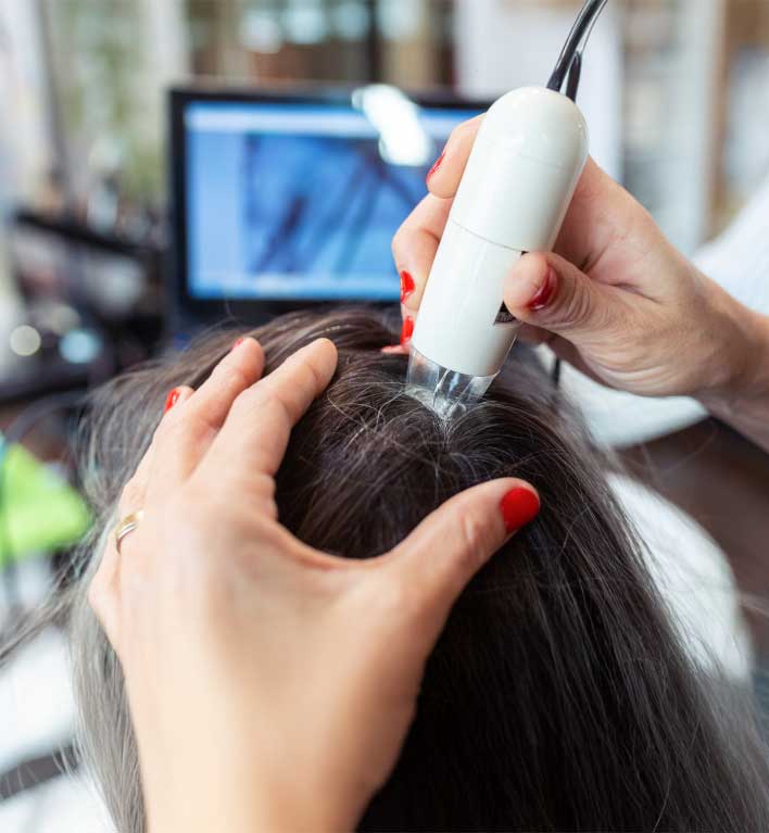 CRLAB-Scalp-Treatment-Therapy-for-Hair-Loss-Dayton-OH CRLAB Scalp Treatment Therapy for Hair Loss Dayton OH