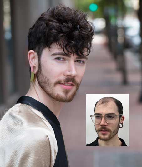 CRLAB-mens-non-surgical-hair-replacement-Dayton-Ohio CRLAB mens non-surgical hair replacement Dayton Ohio