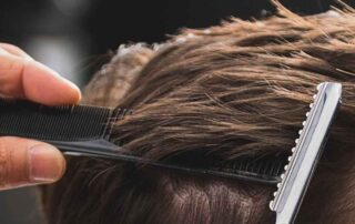 CRLAB scalp treatment hair loss Dayton OH