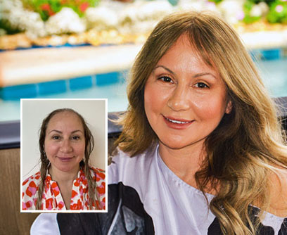 Non-surgical women’s hair replacement dayton ohio HRC Dayton Womens Custom Hair Replacement Systems