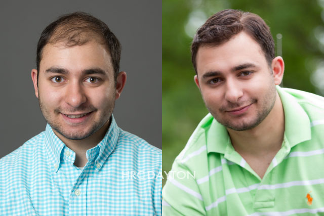 HRC Dayton Mens Hair Replacement