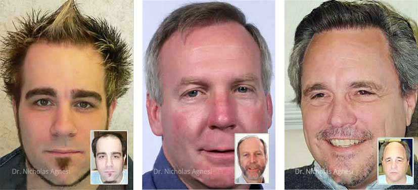 hair-transplant-doctor-clinic-dayton-cincinnati-lexington hair transplant doctor clinic dayton cincinnati lexington