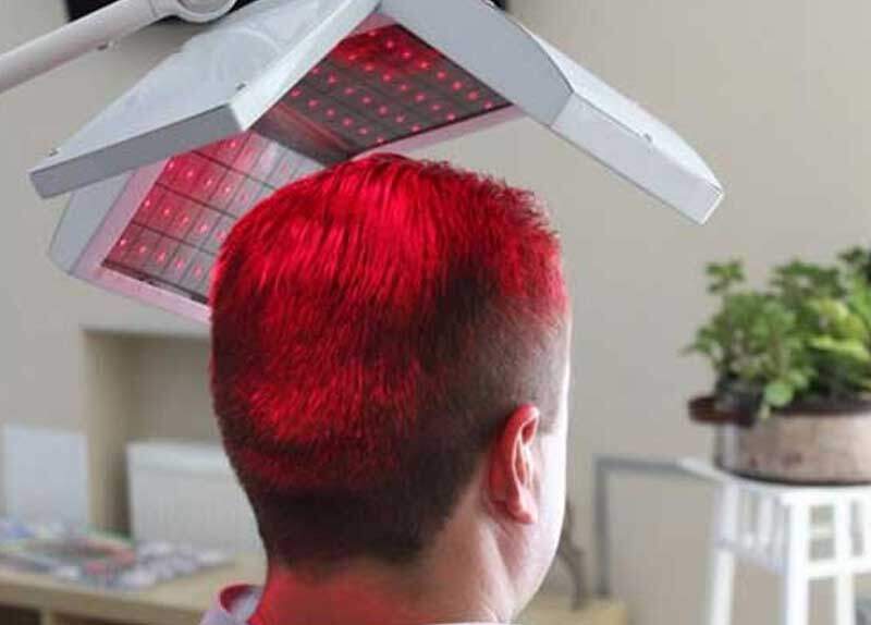 laser hair loss treatment solutions dayton