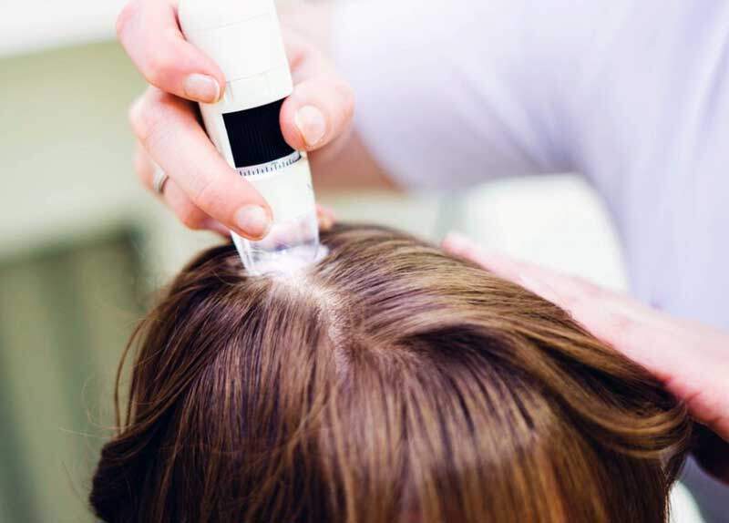 Trichology Hair Loss Treatment Specialist Dayton Ohio