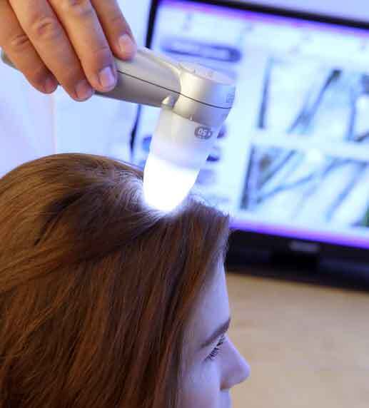 tricological-hair-loss-prevention-treatment-dayton-ohio trichological hair loss prevention treatment dayton ohio