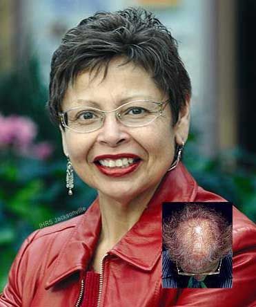 womens hair loss treatment specialist clinic dayton ohio womens hair loss treatment specialist clinic dayton ohio