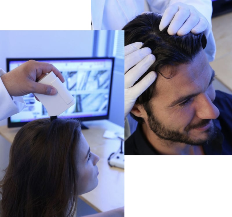 Trichologist Examining Scalp - Dayton Ohio