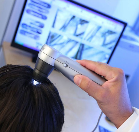 crlab-tricologist-hair-and-scalp-evaluation-Fidenza-Dayton OH crlab extra care daily line trichology treatment dayton ohio