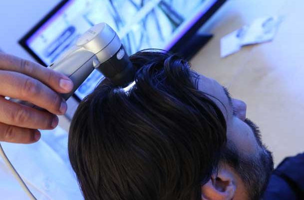 hair loss specialist Dayton Ohio