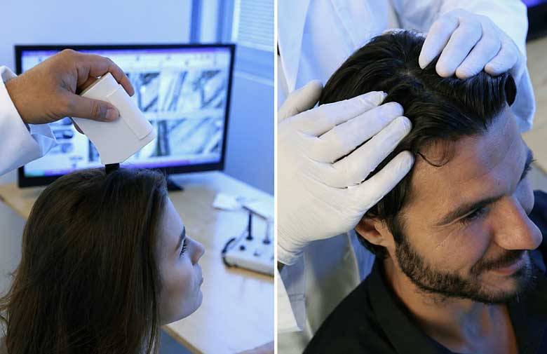 Hair specialist performing a professional scalp analysis to evaluate hair thinning and scalp health before recommending personalized hair restoration options.